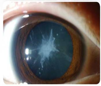 duc thuy tinh the vo