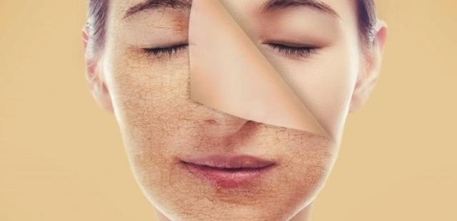 Nguy hiểm khi da thiếu vitamin C không phải ai cũng biết