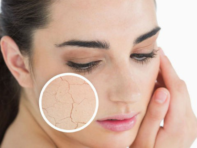 Da khô sần, thiếu nước, nứt nẻ cần làm gì để hồi phục?