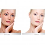 Da căng mịn, trẻ đẹp bằng phương pháp tế bào gốc chống lão hóa Image the Max?