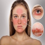 Tác hại nguy hiểm mà các hóa chất trong mỹ phẩm mang lại bạn có biết?