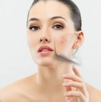 Top 3 sản phẩm trị mụn hiệu quả và an toàn nhất hiện nay