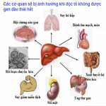 Độc tố tích tụ lâu ngày trong cơ thể sẽ nguy hiểm như thế nào?