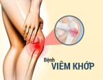 Những thói quen giúp bảo vệ xương khớp khỏe mạnh