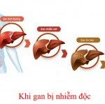 Mách bạn cách thải độc gan từ thiên nhiên rất hiệu quả