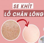 Những tuyệt chiêu giúp bạn thu nhỏ lỗ chân lông