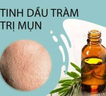 Những loại tinh dầu lý tưởng cho làn da mụn