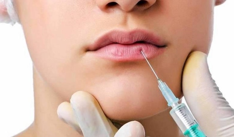 4. Đối tượng nên và không nên tiêm filler môi