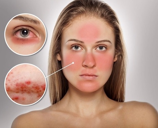 chăm sóc da nhạy cảm 