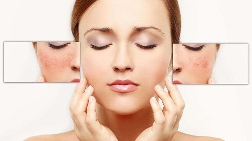 chăm sóc da nhạy cảm 