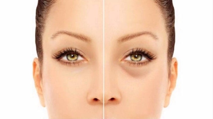 Hướng dẫn phương pháp chăm sóc da lão hóa vùng mắt