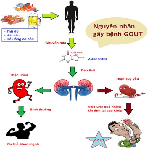 6. Phòng ngừa rối loạn chuyển hóa acid uric