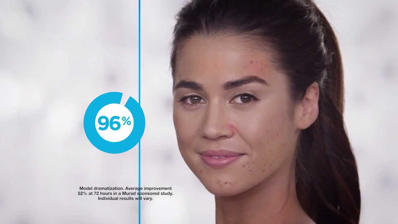 Kem trị mụn Murad Blemish Clearing Solution