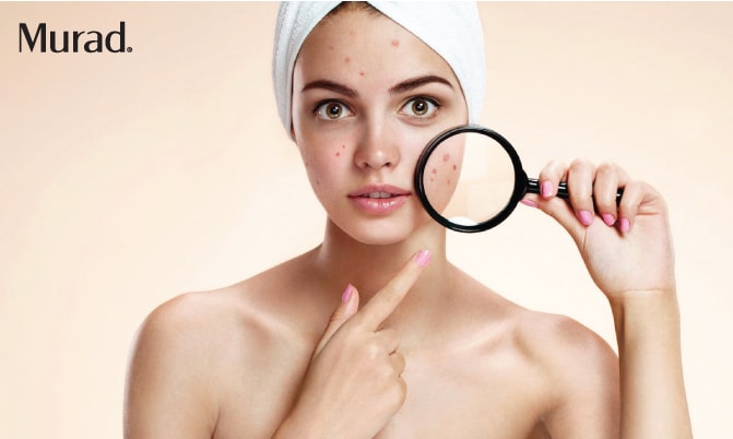 Gel trị mụn bọc và mụn mủ Murad