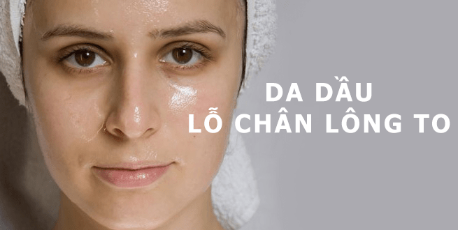 Chữa mụn đầu đen hiệu quả, giảm nhờn ở da nhờ Kem dưỡng ẩm Murad